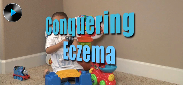 Conquering Eczema