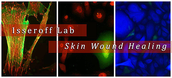 Isseroff Lab - Skin Wound Healing