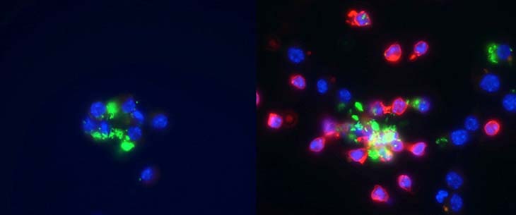Left side of photos shows macrophages infected with Salmonella, shown in green on a black background. Right image shows neutrophils, in red, added to macrophages infected with Salmonella, shown in green, on a black background.