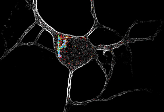 Neuron on a black background