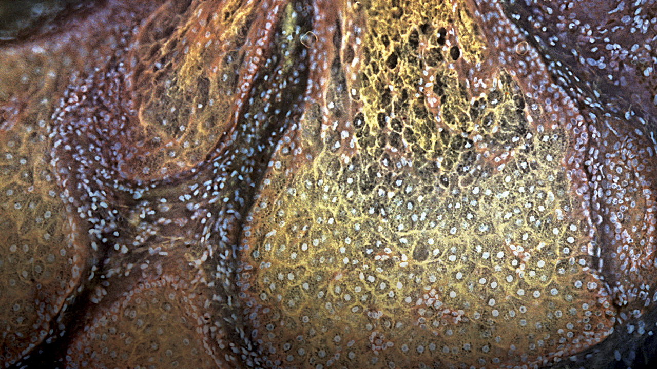 MUSE microscope view of a sebaceous gland