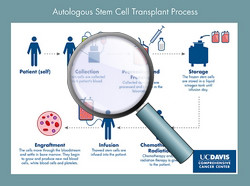 Autologous stem cell transplant process - CLICK HERE TO ENLARGE ILLUSTRATION