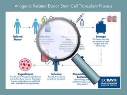 Allogeneic related stem cell transplant process - CLICK HERE TO ENLARGE ILLUSTRATION