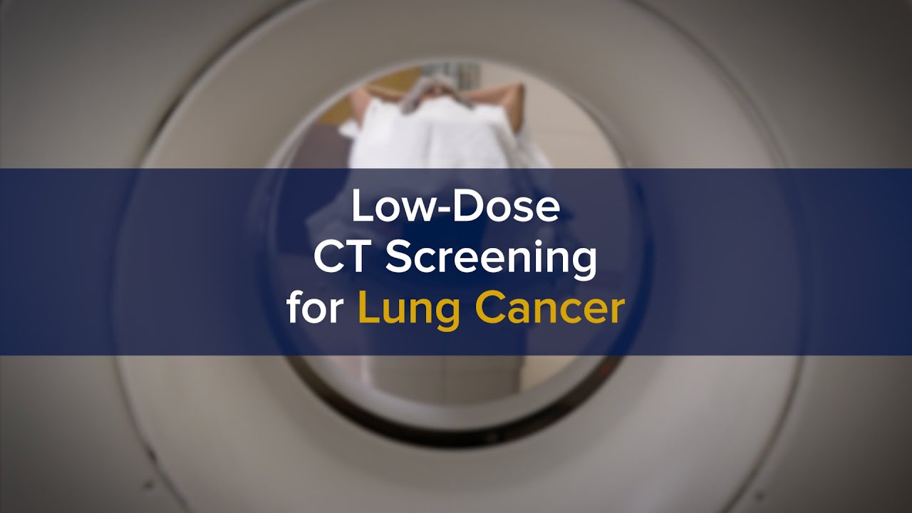 Lung Cancer Home Page