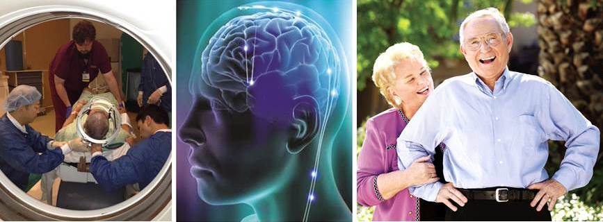 Deep Brain Stimulation Program at UC Davis - compassionate, effective DBS treatment