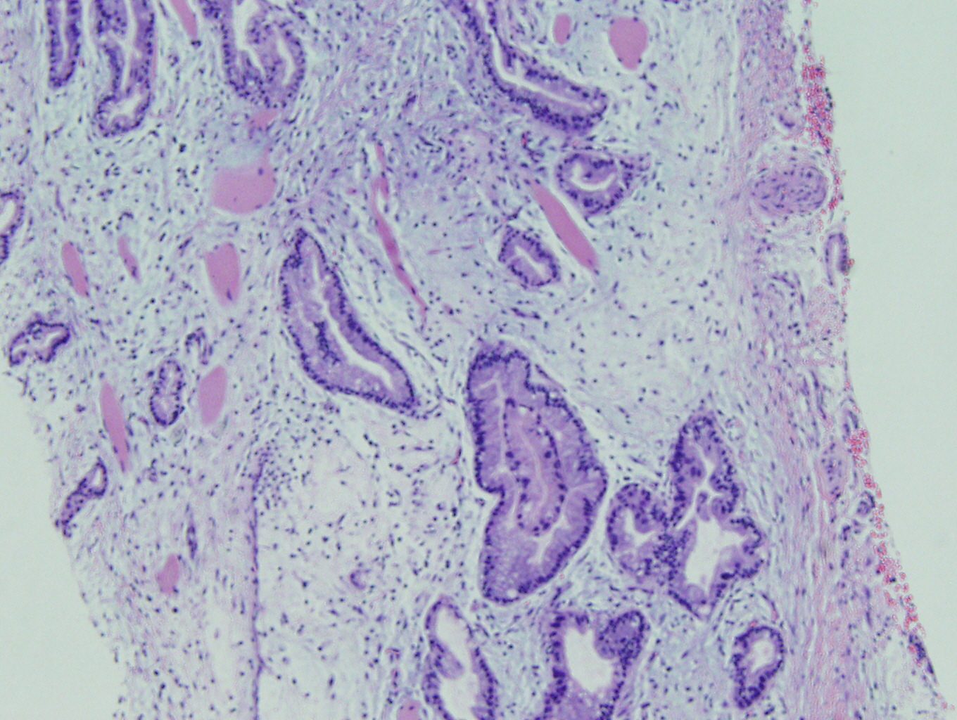Case of the Month, Mar. 2013: Figure 4