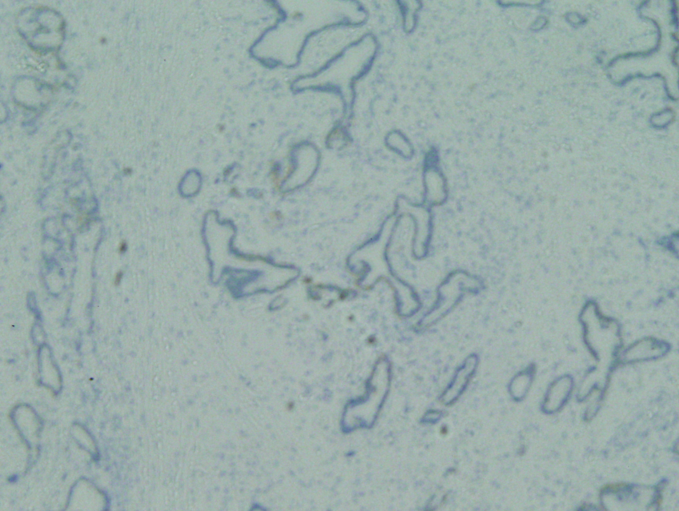 Case of the Month, Mar. 2013: Figure 5