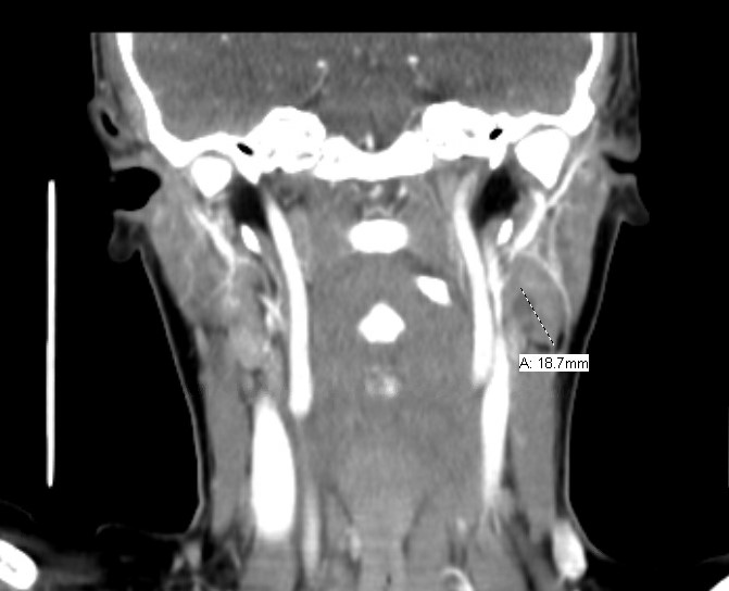 Figure 1: CT scan