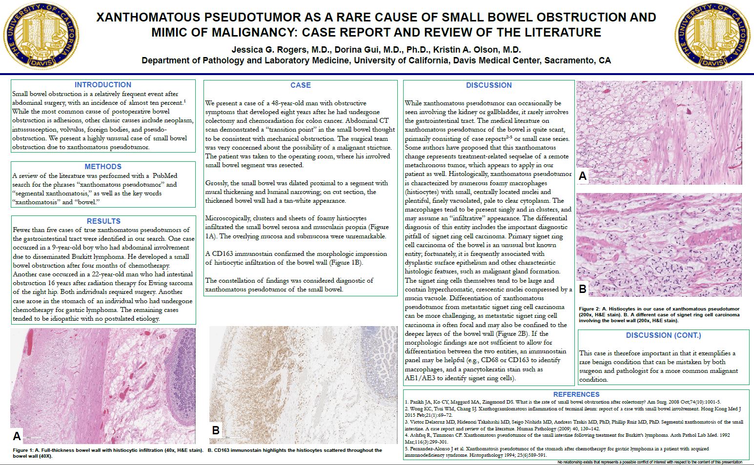 Rogers Jessica ASCP2015 poster